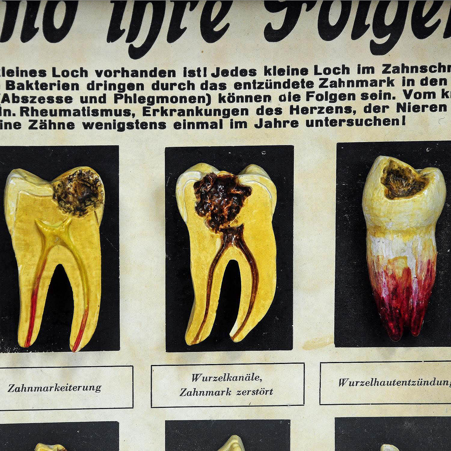 Antique Scientific Teeth Specimen for Class ca. 1930