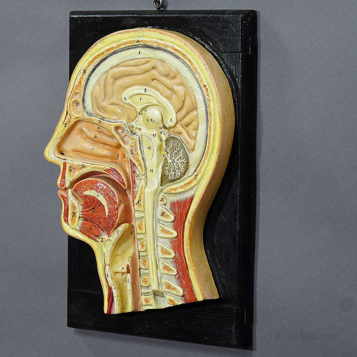 Antique Teaching Aid - Median Incision of the Human Head, ca. 1920 