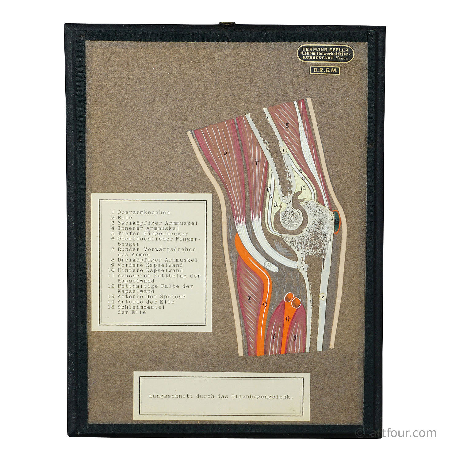 Antique Scientific Showpiece - Bone Cut of the Human Elbow
