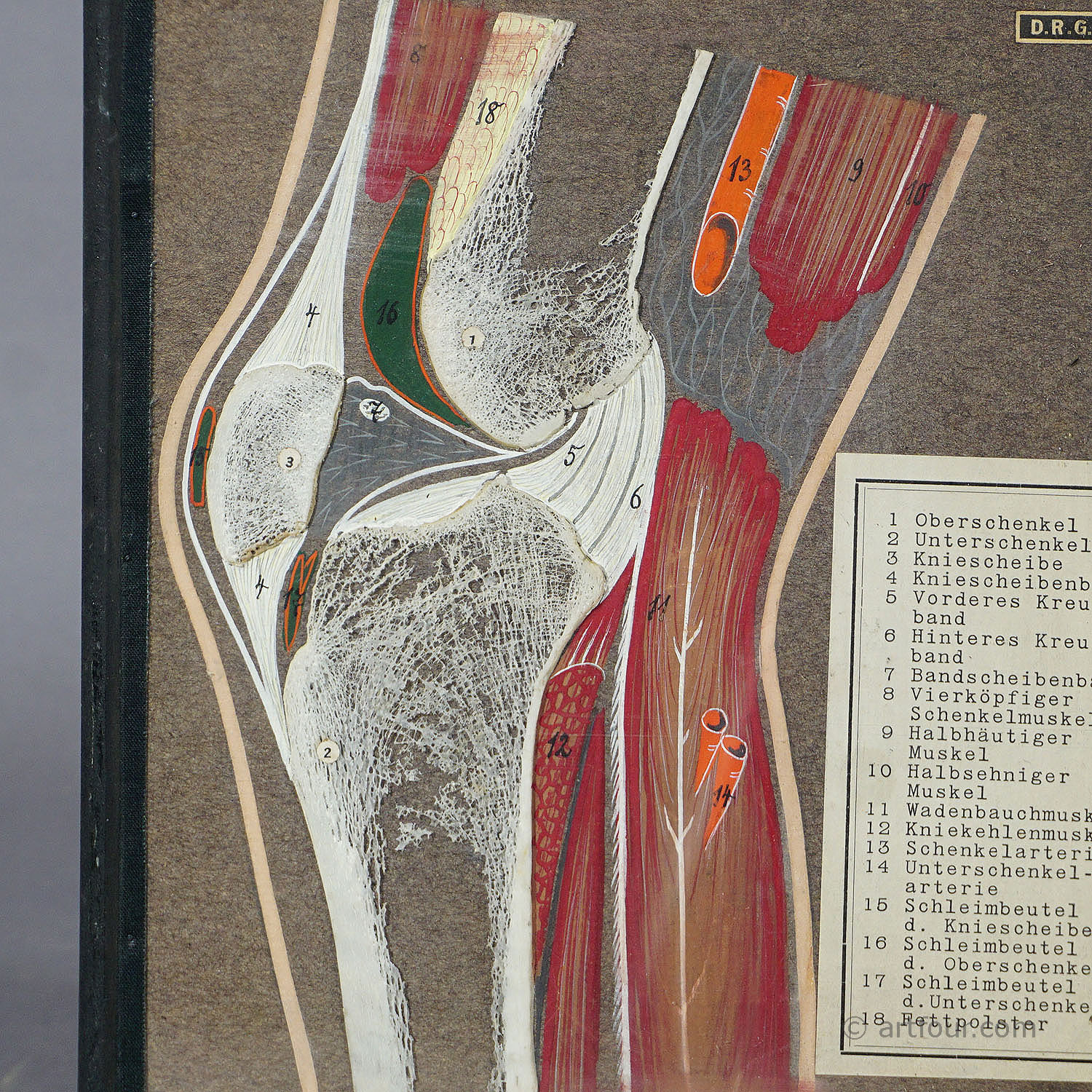 Antique Scientific Demonstration Model - Bone Cut of the Human Knee Joint