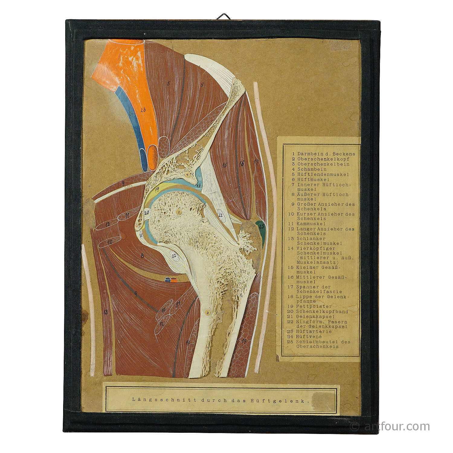 Antique Scientific Demonstration Model - Bone Cut of the Hip Joint