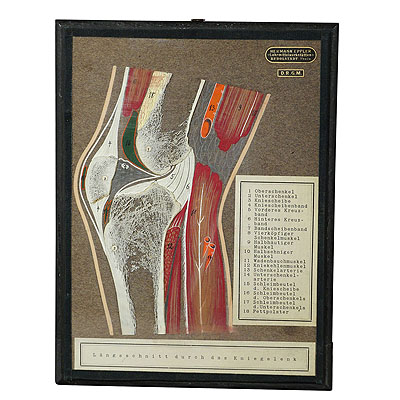 image of Antique Scientific Demonstration Model - Bone Cut of the Human Knee Joint